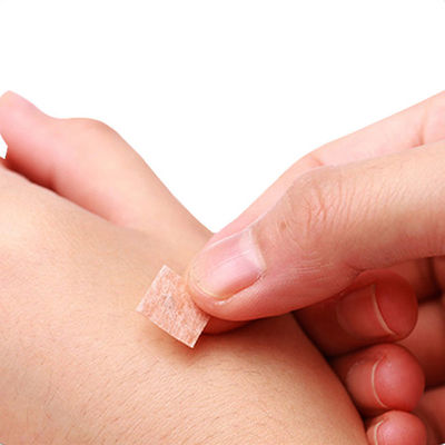 プラスチックハンドル鍼 GB 2024-2016 有効で快適な治療のための安全基準